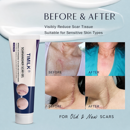 COMBO TIMILK Scar Vanisher Gel – Advanced Silicone Formula for Scars, Stretch Marks & Smooth Skin (Before & After Results)